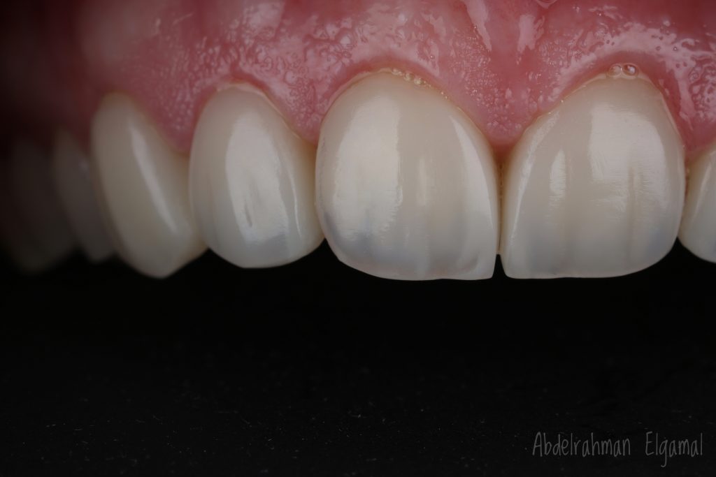 D0CB2989-9CA6-4ECD-8124-D8BB66DF2354