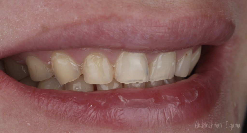 D745E93B-301F-472F-8C37-77FADC41BF41