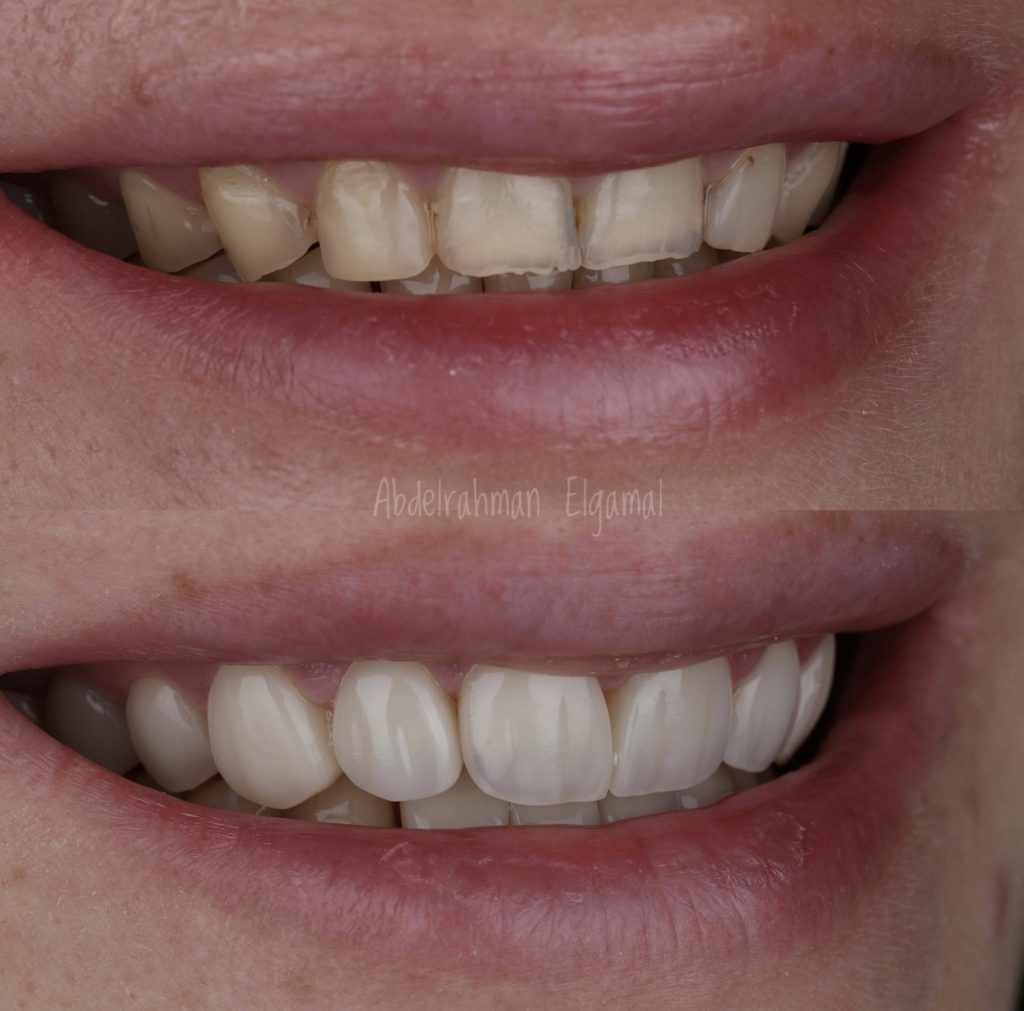 E14DCA67-0F9D-475C-ADD7-805FEE589EDC