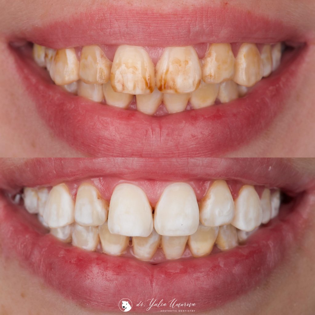 E1DB174D-A2D0-403C-BDF7-176E0237E933