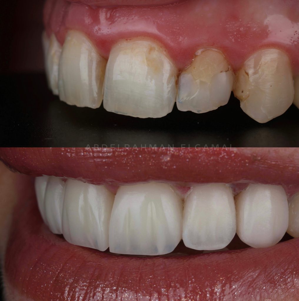 E59D40D0-DE1C-41D6-800B-8D9A993BC988