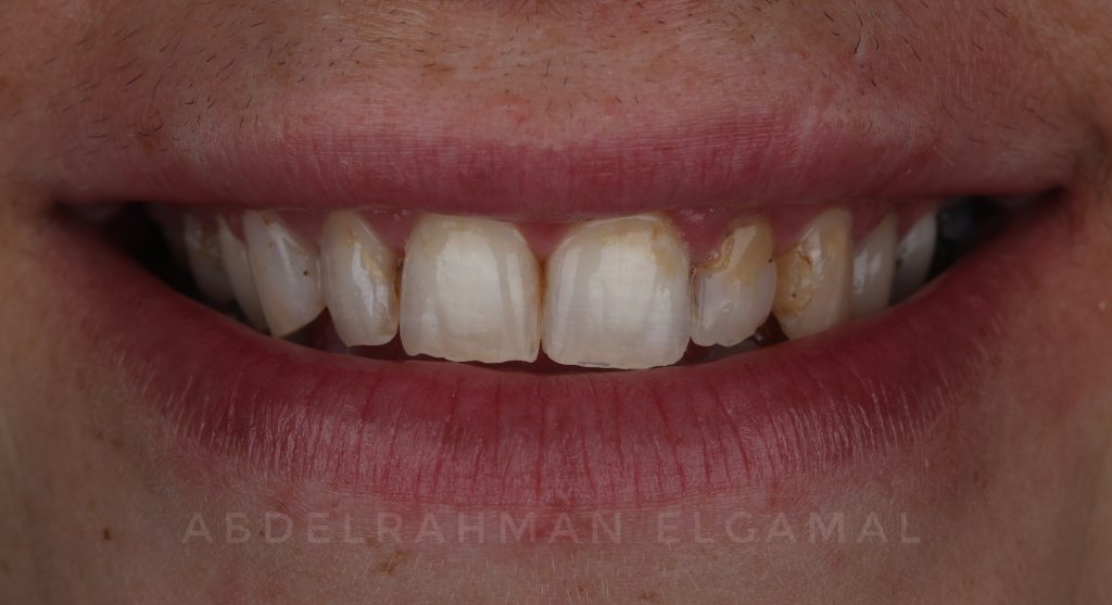 F26D95A5-5498-425F-8D93-114E37BADDC2