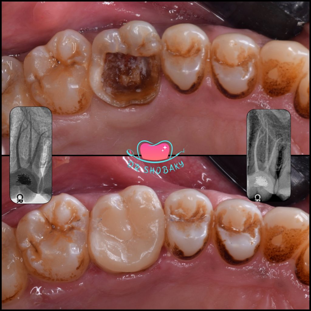 FCE4A9F0-A3B3-41BE-8F97-637013A65A4B