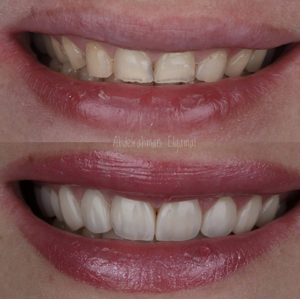 FF7636E5-92AD-41B8-ABB2-6B11CA85DFF8