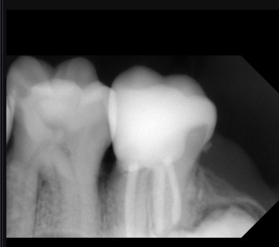 IMG_5706_Facetune_21-08-2024-21-47-02