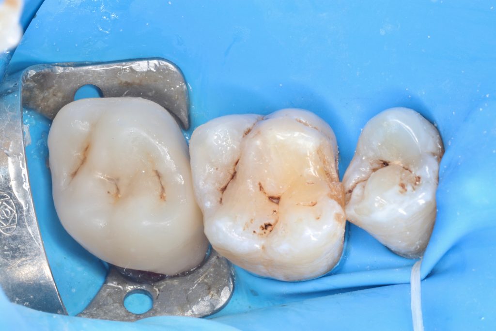 IMG_5707_Facetune_21-08-2024-21-35-57