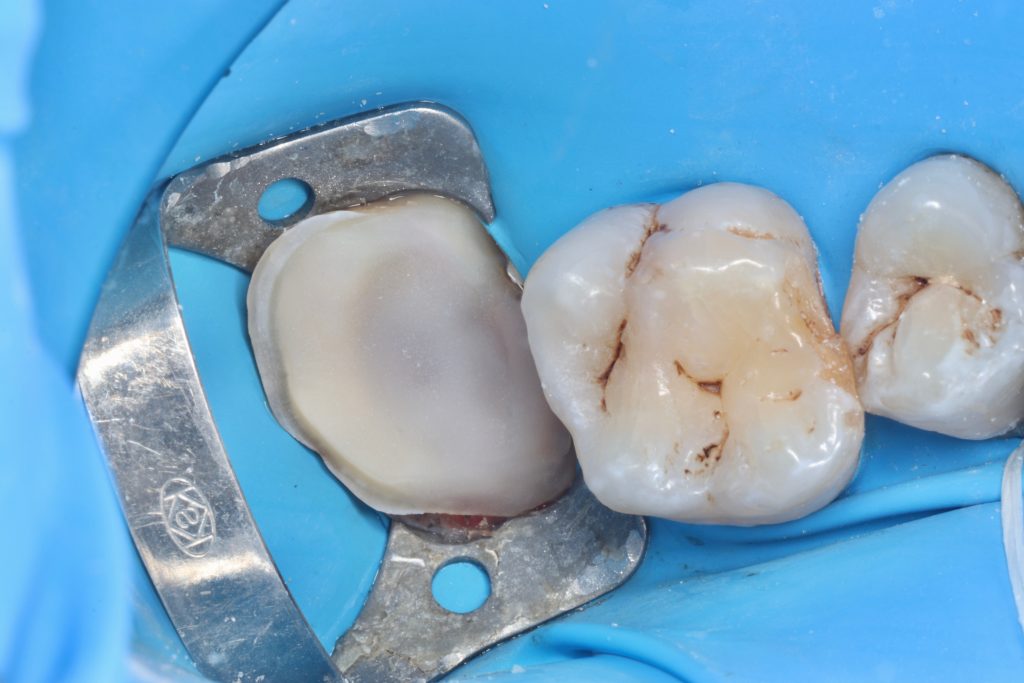 IMG_5708_Facetune_21-08-2024-21-36-22