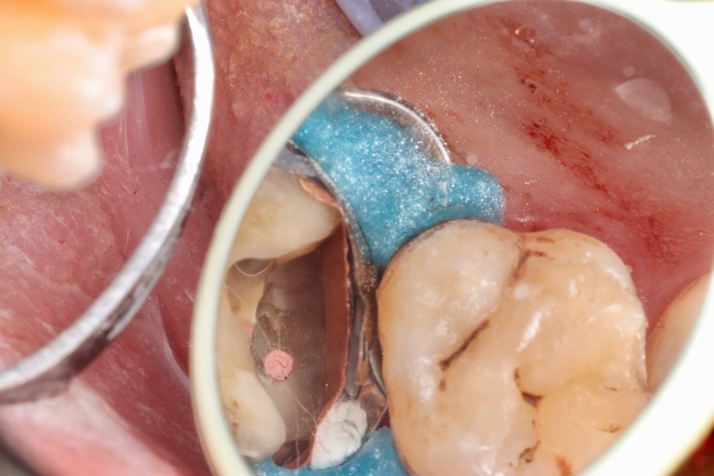 IMG_5716_Facetune_21-08-2024-21-39-37