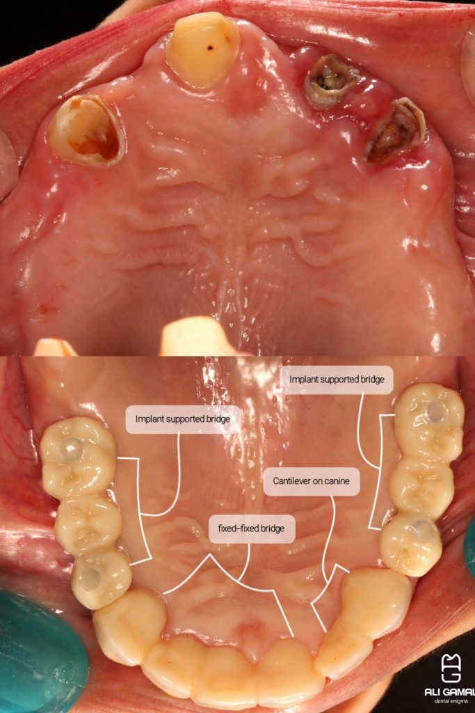 InShot_20240728_185808418