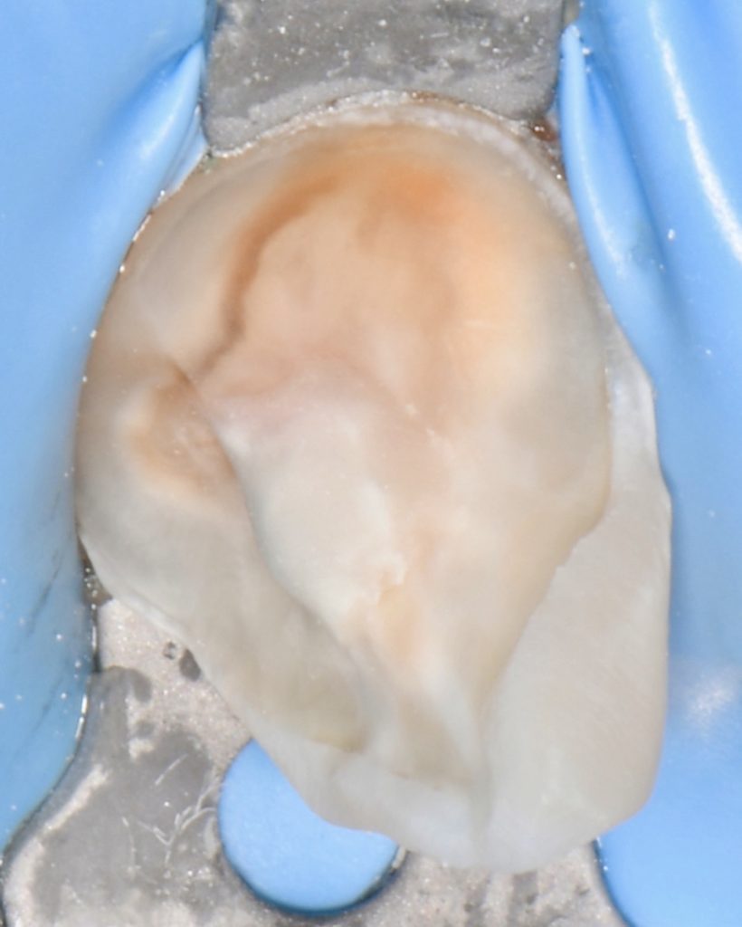 20421EBD-7583-404B-9606-336E611D36D6