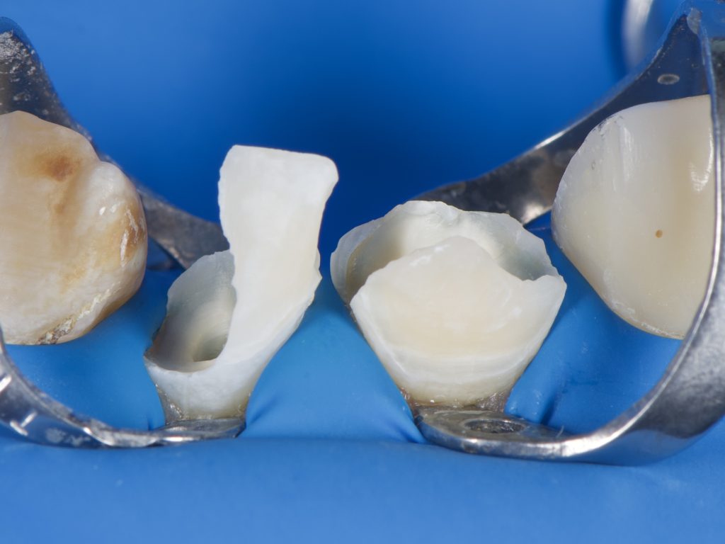 31FCE7AA-6023-4AC7-928F-9B90C02A9065