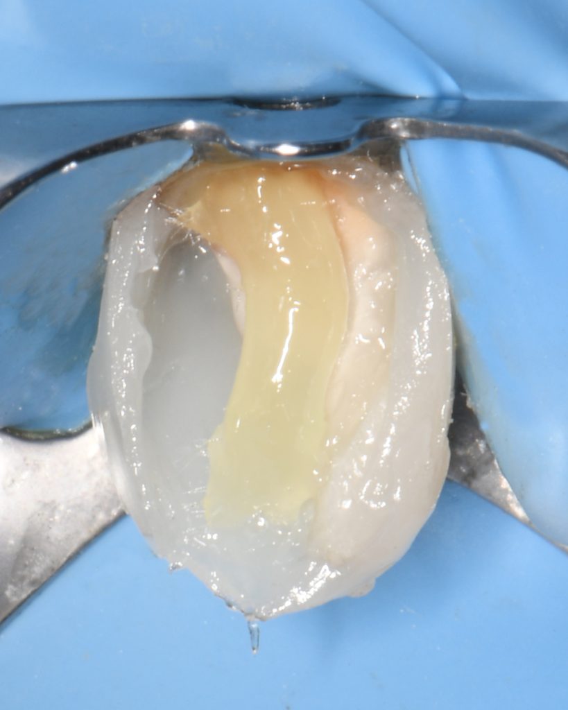 441CF282-081F-44A6-A7BE-886DA006DC8B