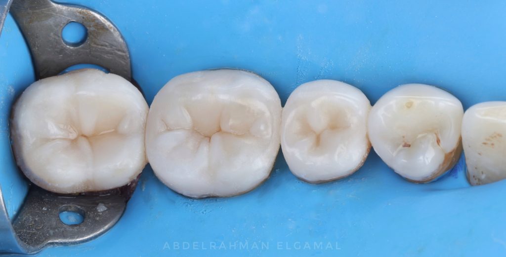 60FAB830-AFF3-4A5C-91E2-B8CB01ACC9E3