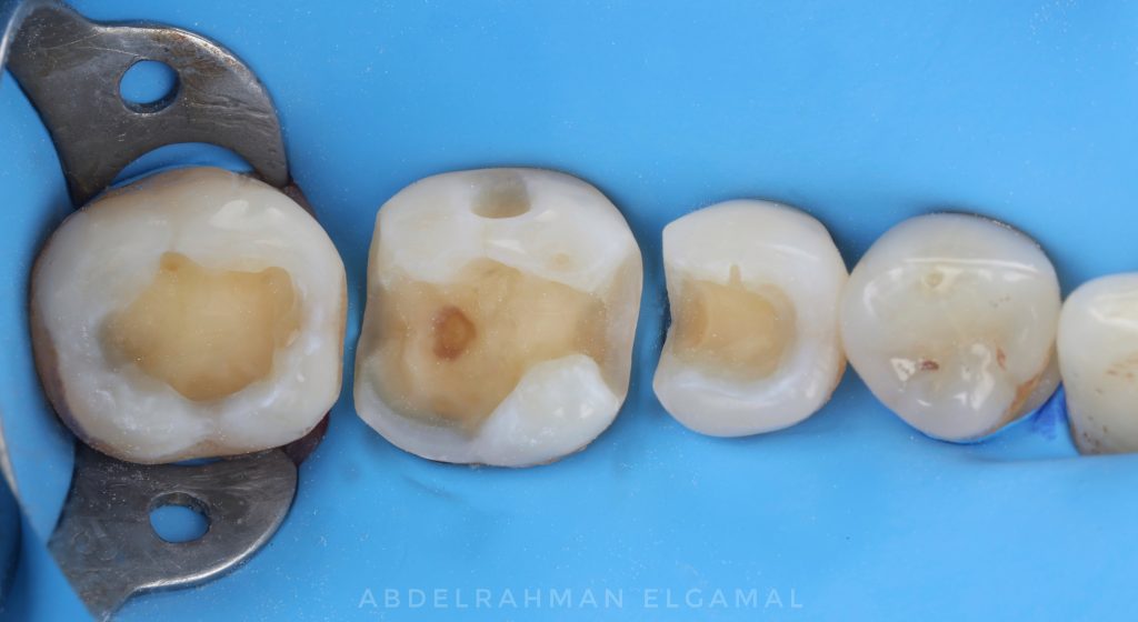 6D69FC92-F2F3-4234-B6EB-3BE734A2B3B1