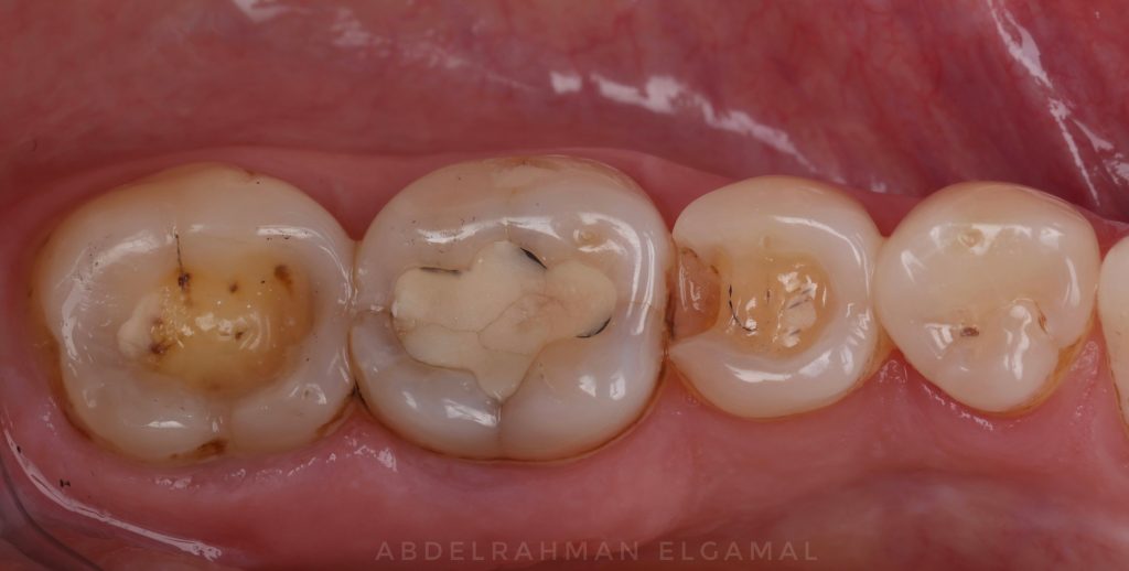 6DCCCFD4-F670-4365-B1D1-816A3ABF728D