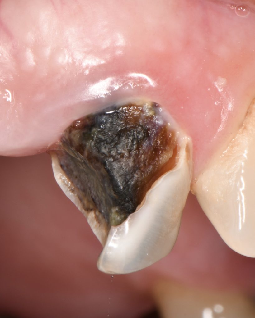 A1A48B58-7D34-4935-83F4-2DD8C8E89695