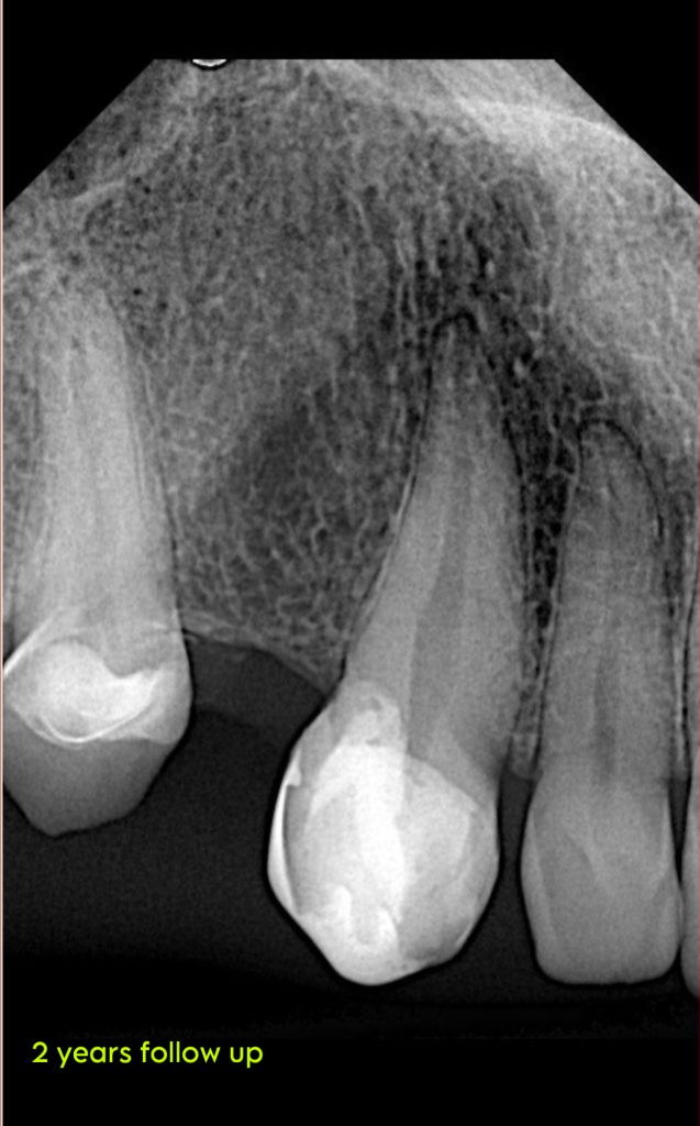 A7106D0F-83DB-4D8B-99CB-EB3BB5C7B12A