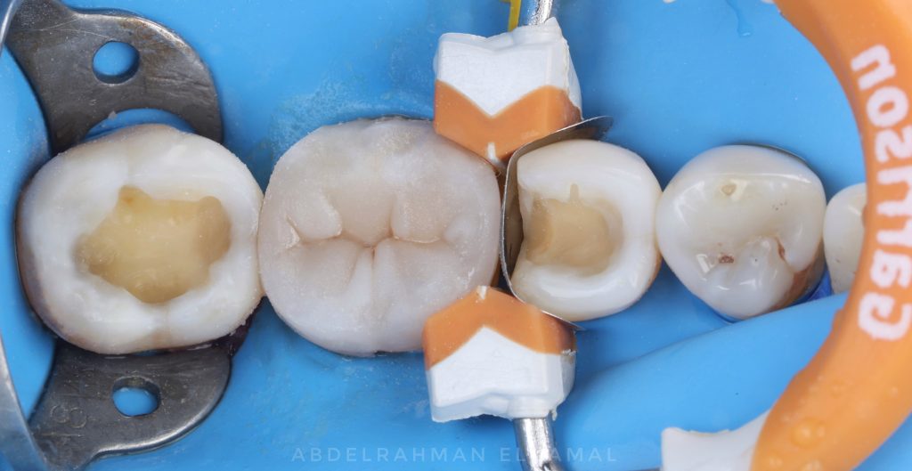 B6C884A9-0716-48F3-98DB-B56E2DB41ACE