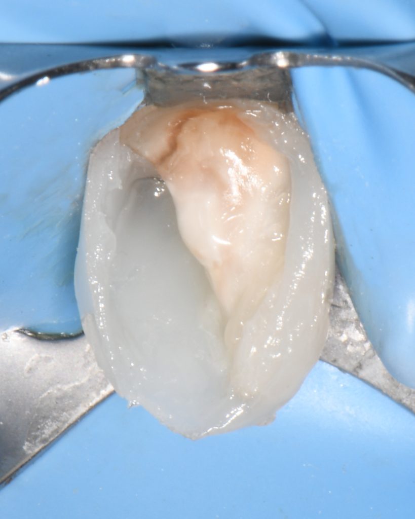 CBBD6541-AFA3-4773-9D5E-AA87A8D7F6CE