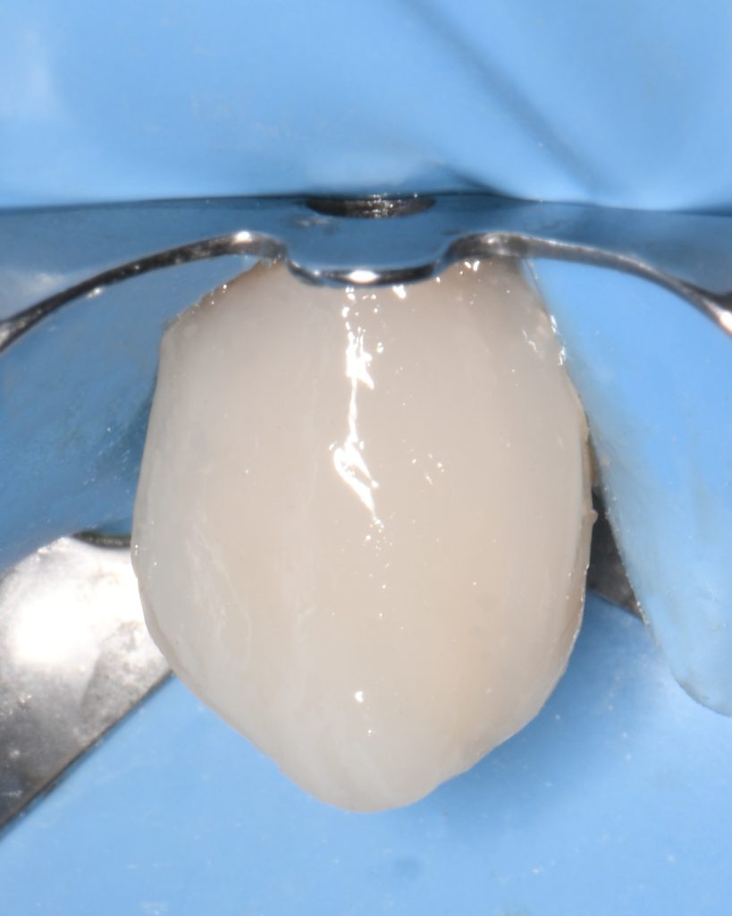 D67C9ED1-881D-4D1A-B08D-F217E62D0EA0