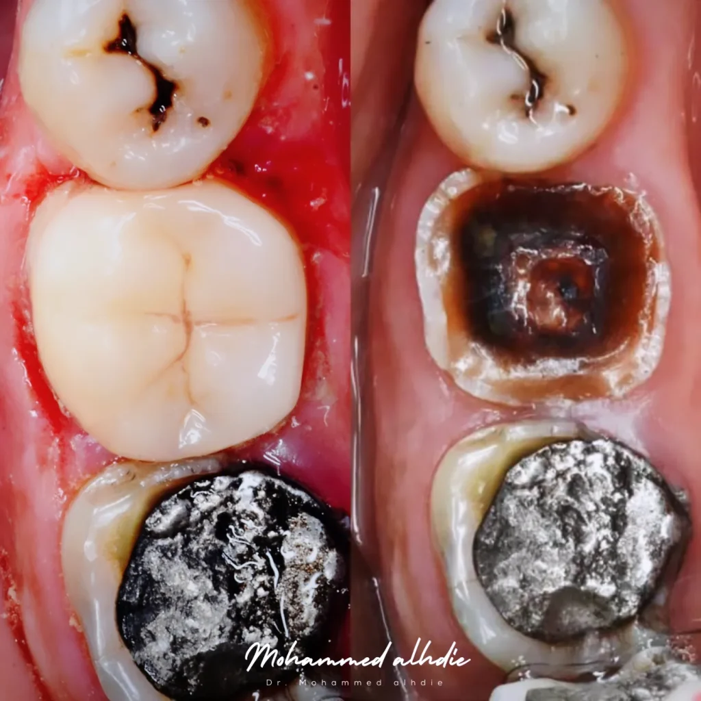 IMG_20240911_225024_686