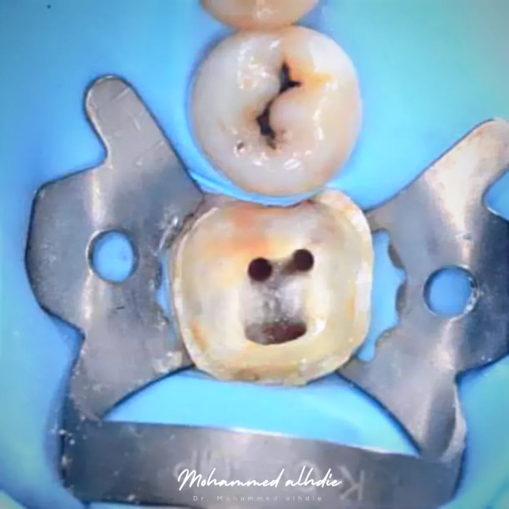 IMG_20240911_225024_932