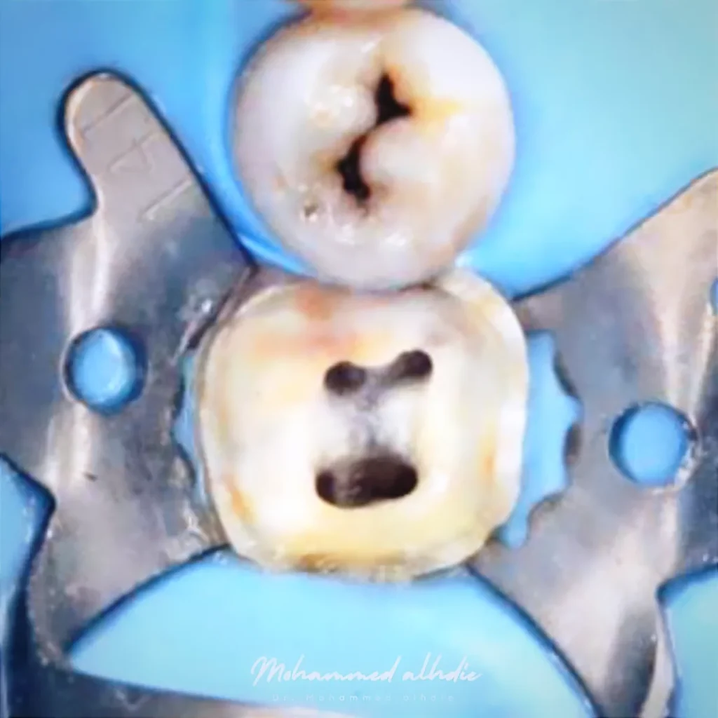 IMG_20240911_225024_986