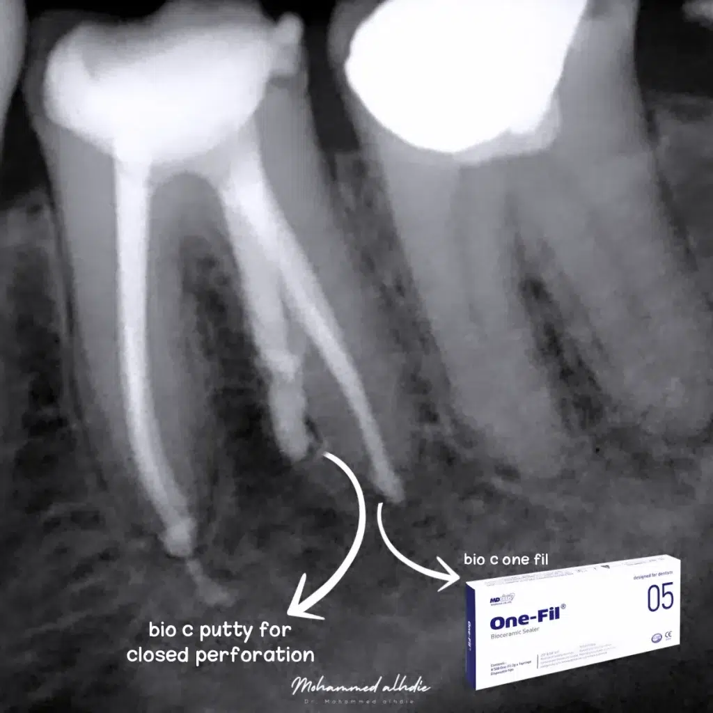 IMG_20240911_225025_095