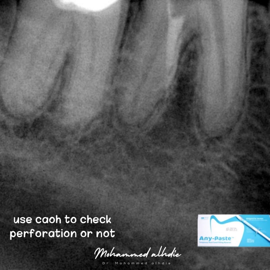 Picsart_24-09-11_22-02-44-497