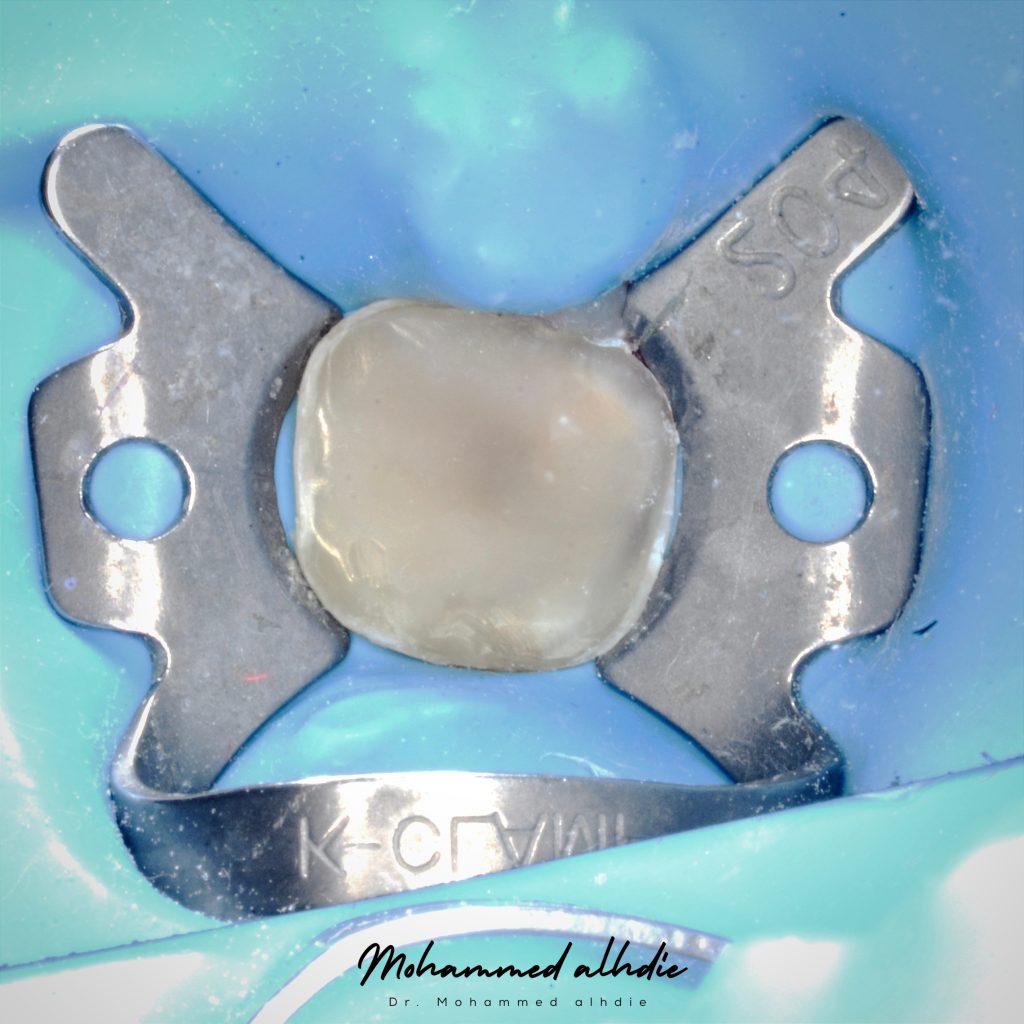 Picsart_24-09-11_22-04-33-276