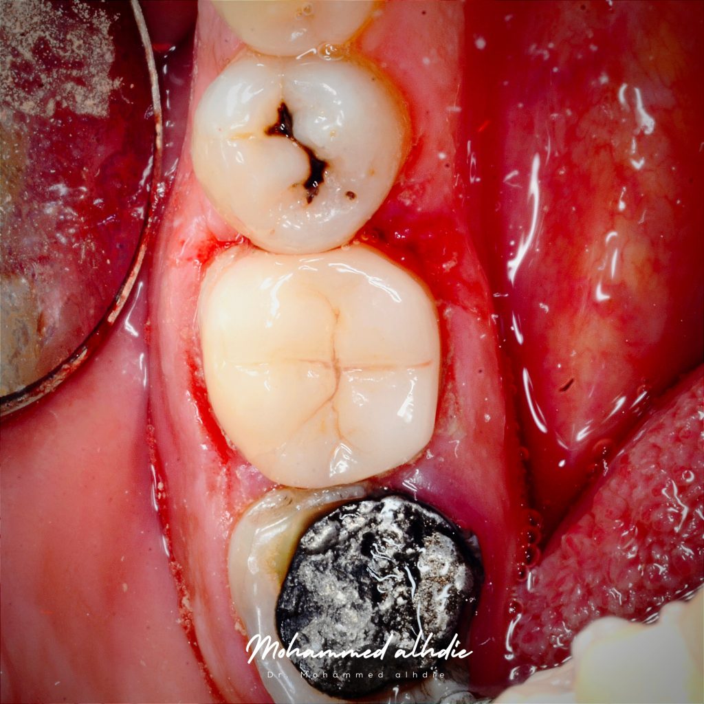 Picsart_24-09-11_22-05-07-085