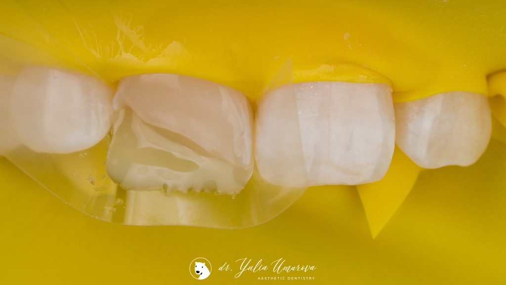 0008DF5A-C8D0-4F1E-BDC0-03F129B11AA5