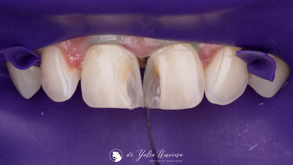 05180E64-B914-4648-A1D8-FD7B59D72D32