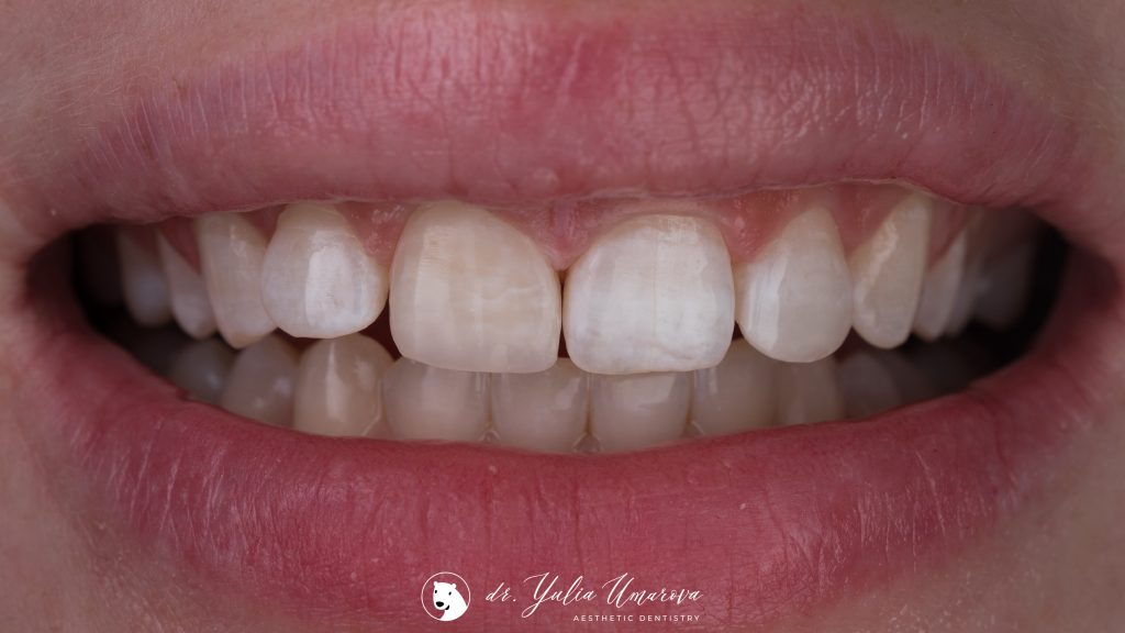 06BECCE8-9C6B-4F78-91CA-B4D700864CD8