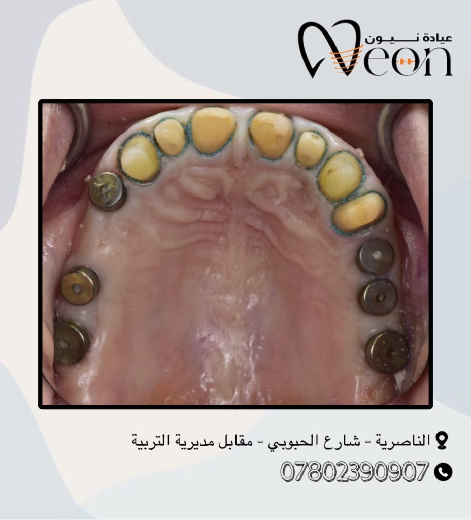 093AFAA6-E2E2-488F-8656-455392527D67