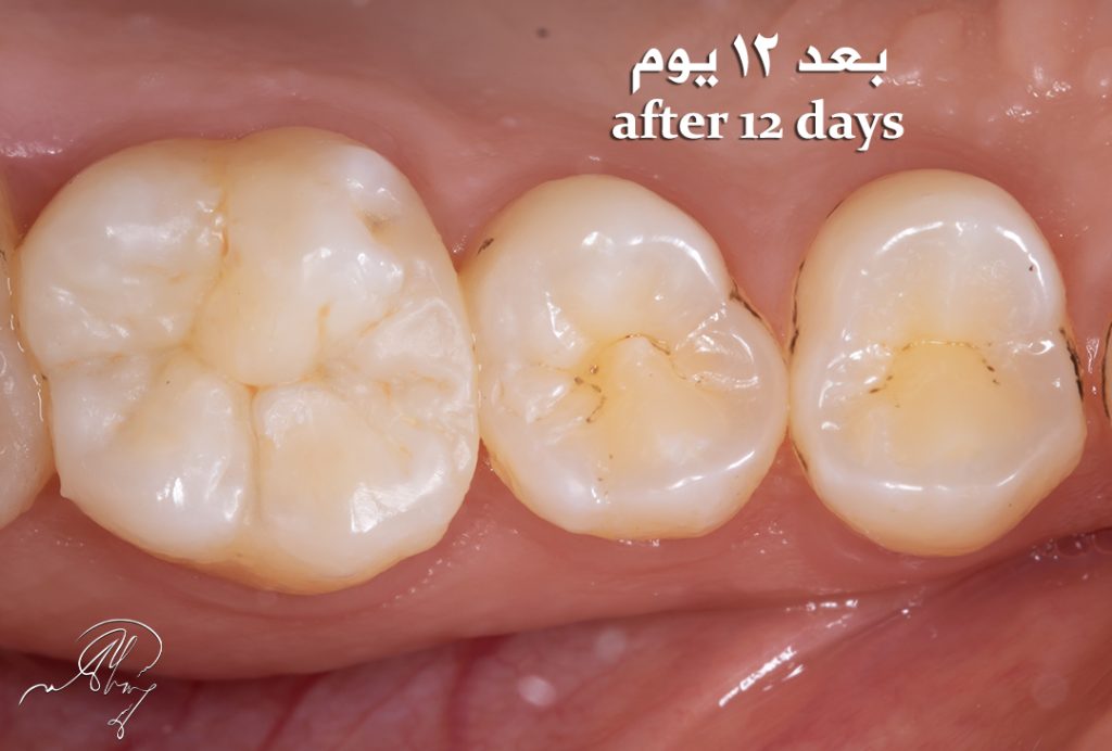 18DBCE01-D340-4550-A2A6-202EA66A8175