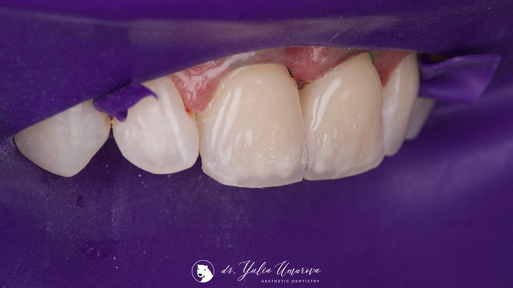 2594A1C8-C907-48FD-8841-CDC5E416E6E4