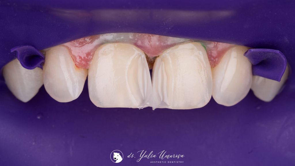 28CA5341-7508-498D-A106-F24D1DB8952A