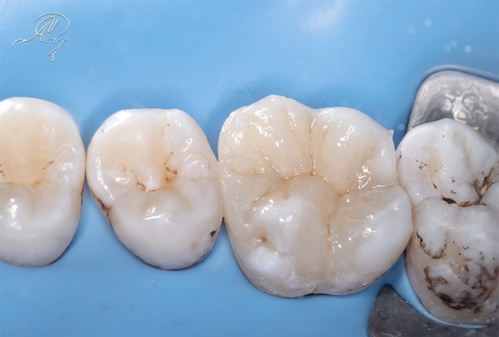 2CE07B10-6DA5-4D7B-A033-2B3BA6D41EF6