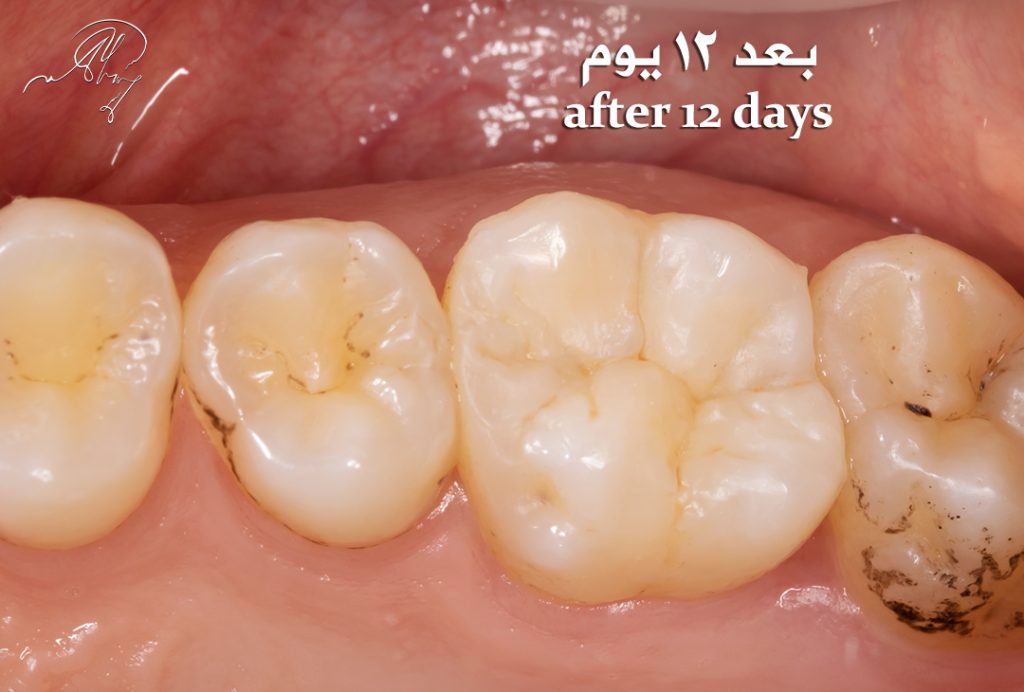 2E122987-7AE1-45A5-9E27-06FDC6837629