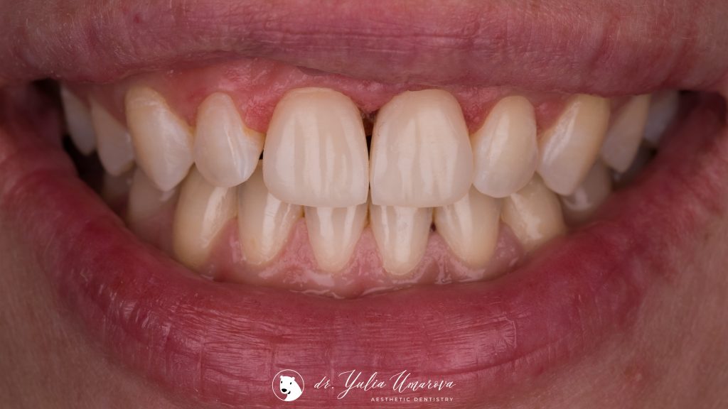 3EB9B1F4-B959-4EB0-A197-3B7690557117