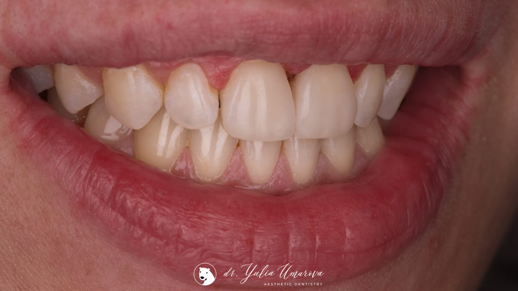 4026AB8B-A280-409D-8542-19F2E8A9E2B8