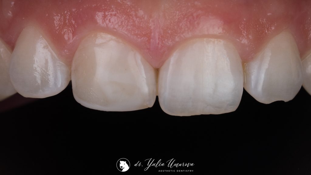 45AA880A-2E6B-44CF-8F68-59A1A0AEF330