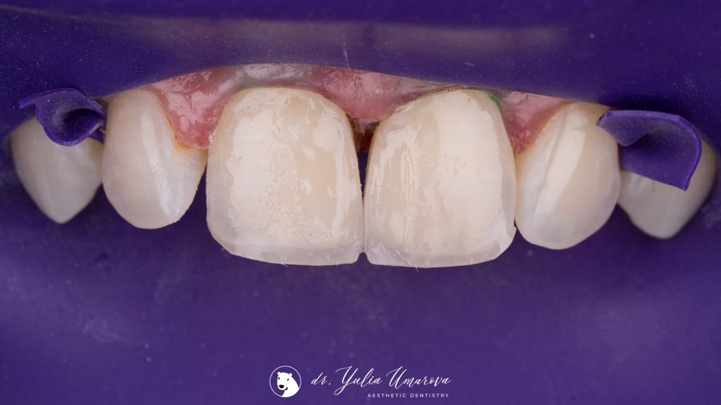 51DC68F1-CE87-4EE1-86C5-2E1949DE38E9