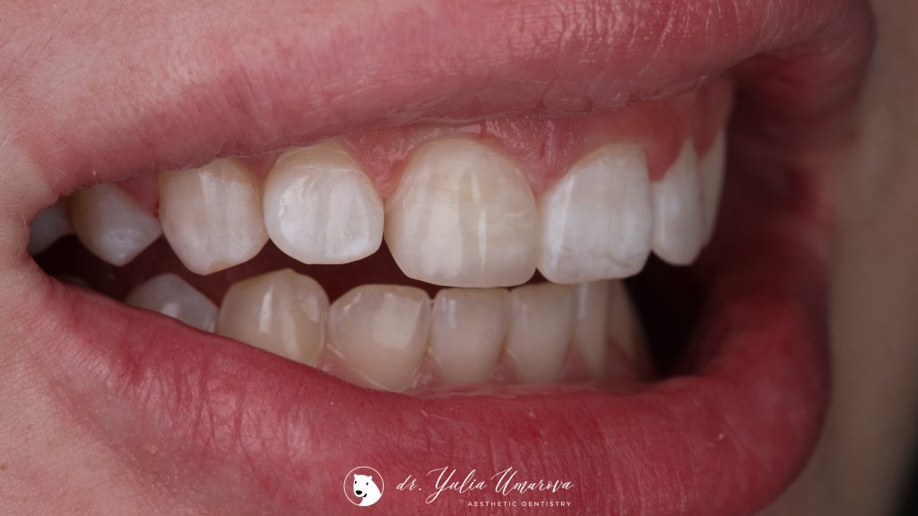 5F6BC537-F5F0-4982-8A34-DFF179398122