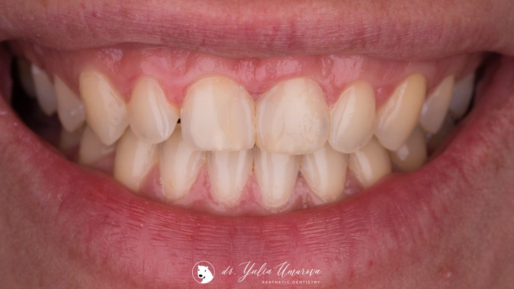 60F23DC6-2CDD-4887-B294-85FC02B8E501