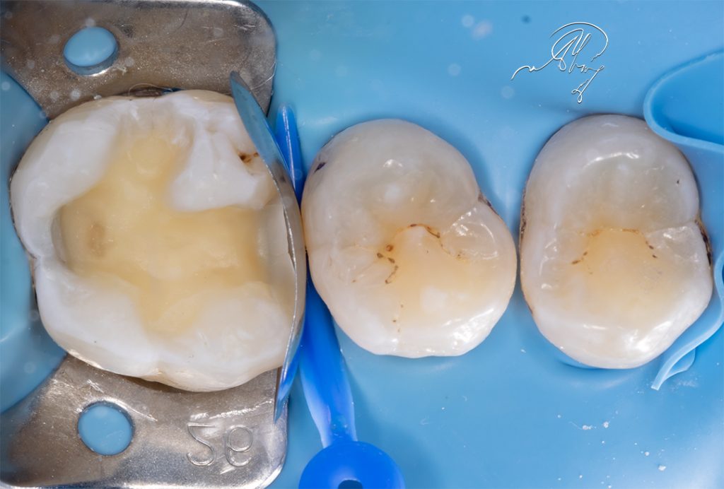 6E530D9B-D87A-4BB7-86DB-7CB7663FC6B8