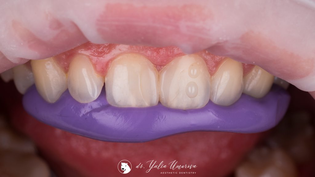 7E613F4D-18D5-4E90-B13D-75B4CC5F14C3