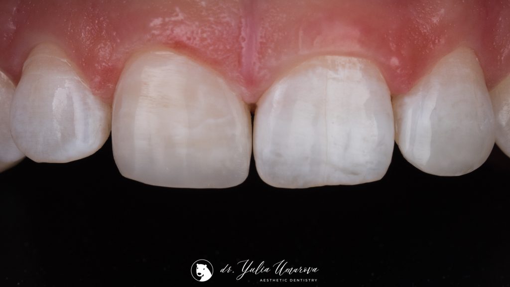 835DF1F0-A65E-4110-A64F-8433B6439070