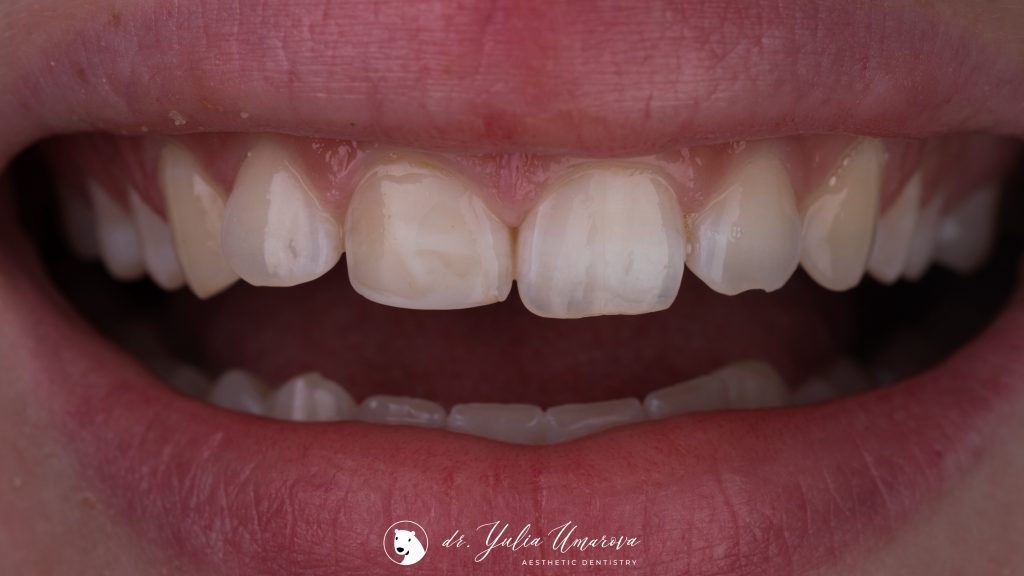 8809CF2A-CAD4-41D4-AEB0-46D8159F1A84